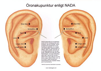 Öronakupunktur NADA, A4-format