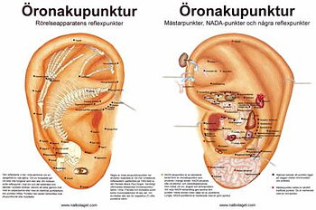 Öronakupunktur, bokformat