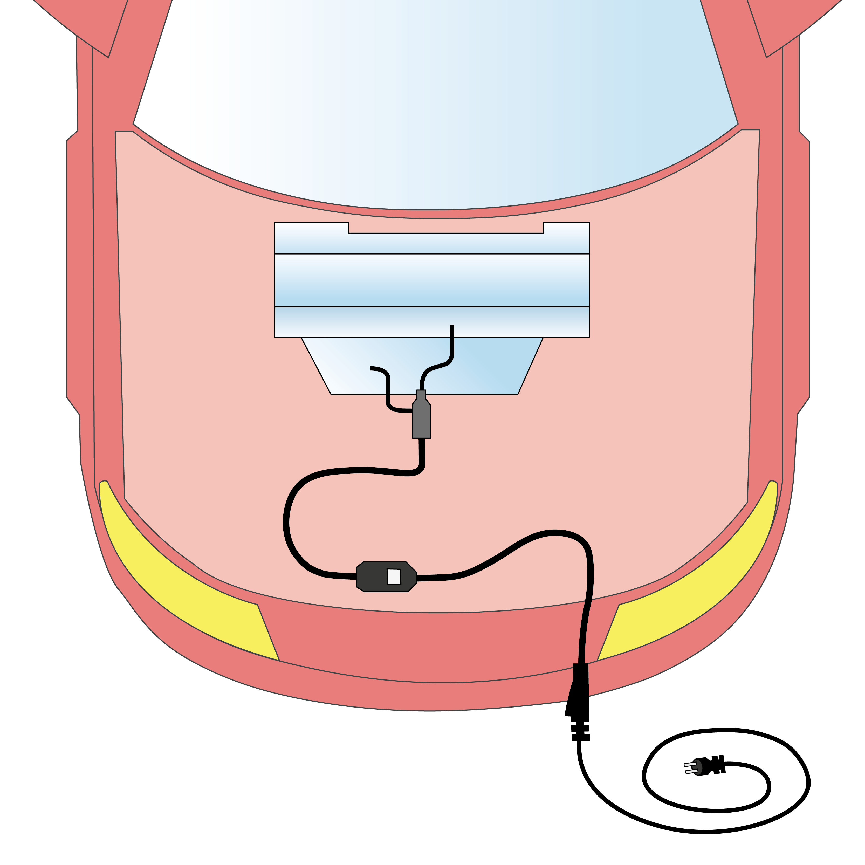 Engine Heater Kit