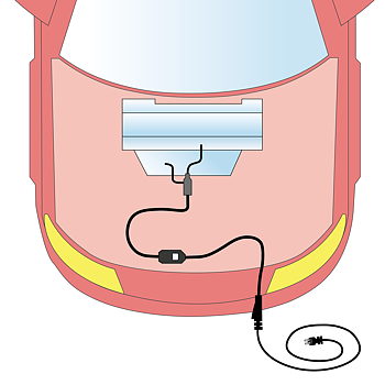 Engine Heater Kit