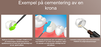 Clearfil ceramic primer plus 4 ml