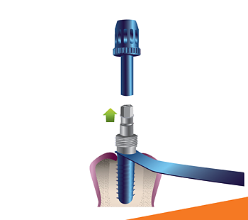 Oktagon Release key BL NC