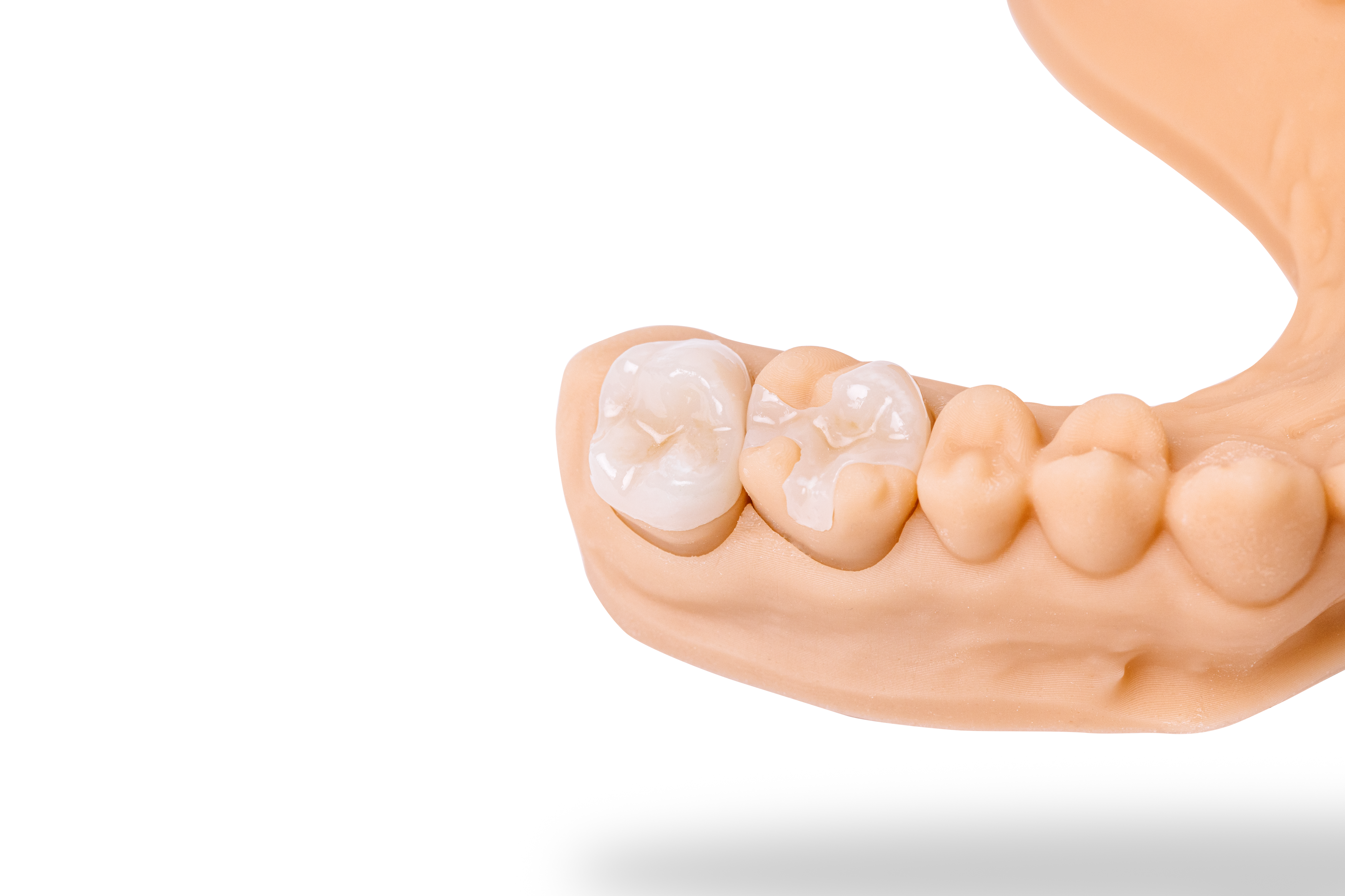 Detax Freeprint Crown A3 1000 g - 3
