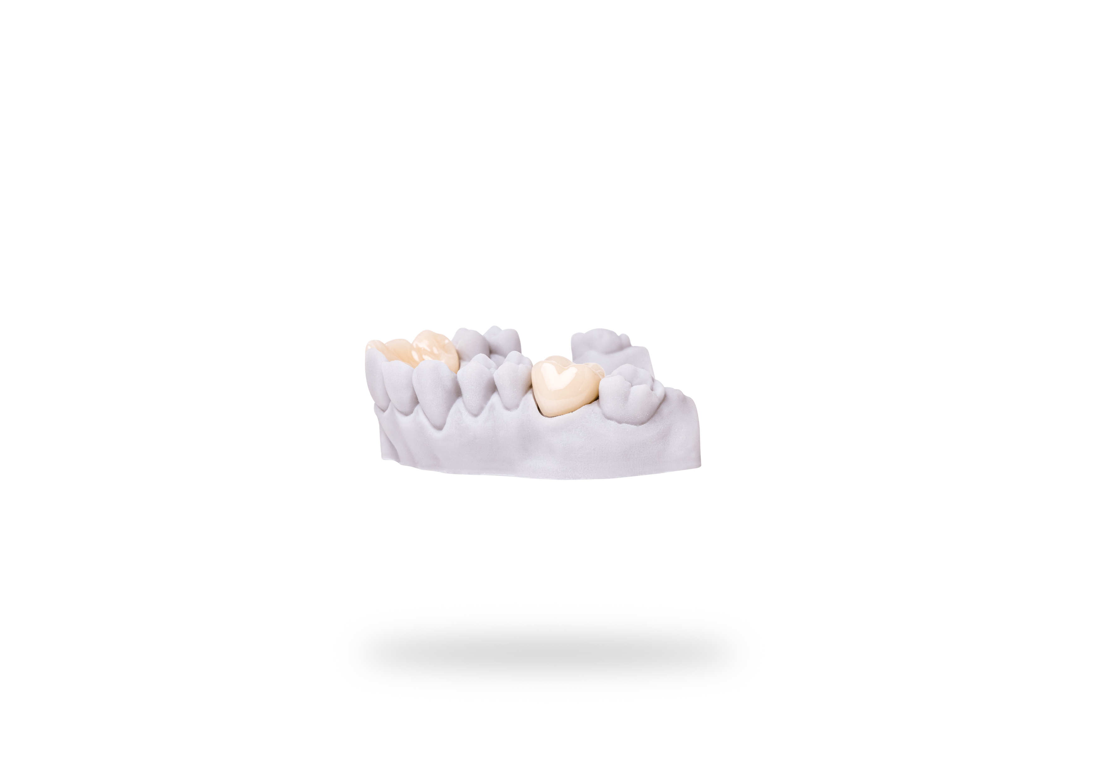 Detax Freeprint Crown B1 500 g - 7