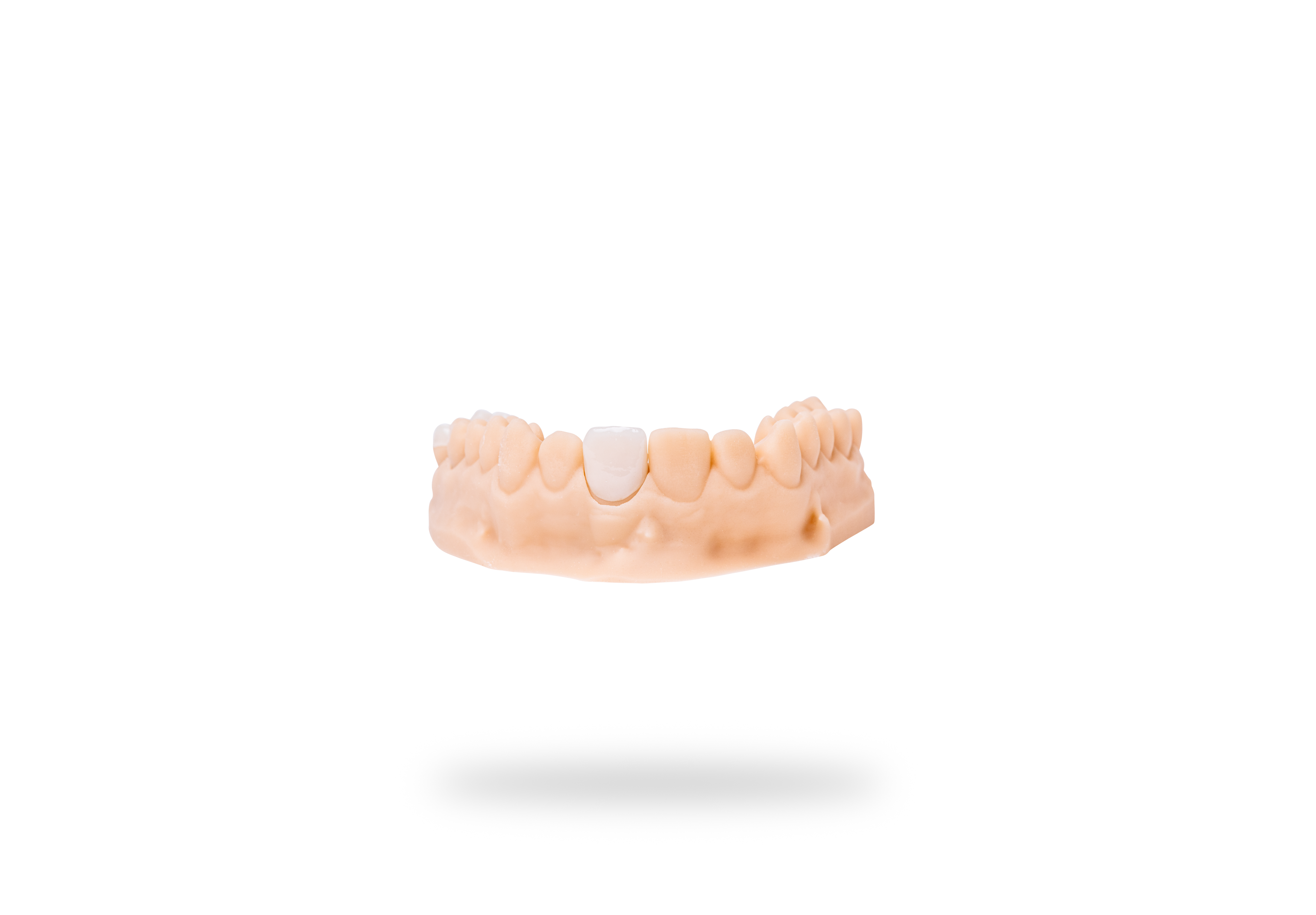 Detax Freeprint Crown B1 500 g - 6