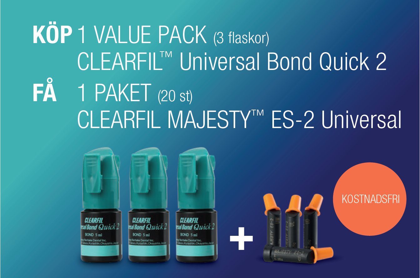 universal bond quick