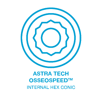 Astra Tech® Osseospeed