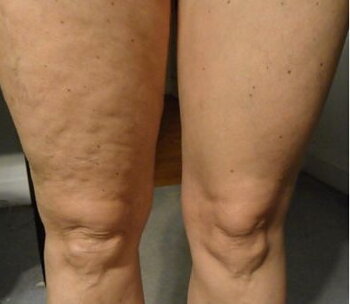 Super Skin Tightening Body Lotion 30 ml