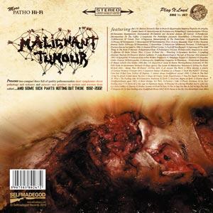 Malignant Tumour - And Some Sick Parts Rotting Out There 1992-2002 [2-CD]