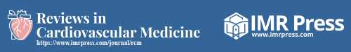 Shared Binding Properties Between a Therapeutic Antibody and Anti-Transthyretin Antibodies From Transthyretin Cardiac Amyloidosis Patients: Translational Implications for Future Clinical Trials