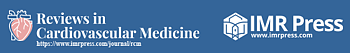 Shared Binding Properties Between a Therapeutic Antibody and Anti-Transthyretin Antibodies From Transthyretin Cardiac Amyloidosis Patients: Translational Implications for Future Clinical Trials