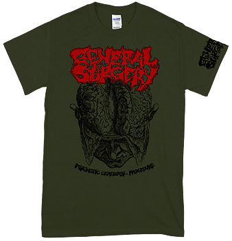 GENERAL SURGERY - Psychotic Cerebral Procedure Green T-shirt