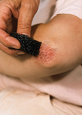 Grovporig Skäggstubbs svamp - Stoppel Sponge - 2
