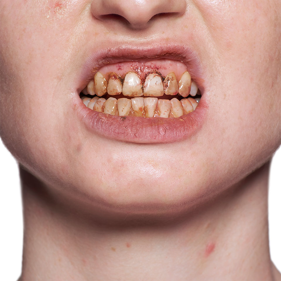 Tandlack / Tooth Enamel BROWN/BRUN 12 ml - Kryolan - 2