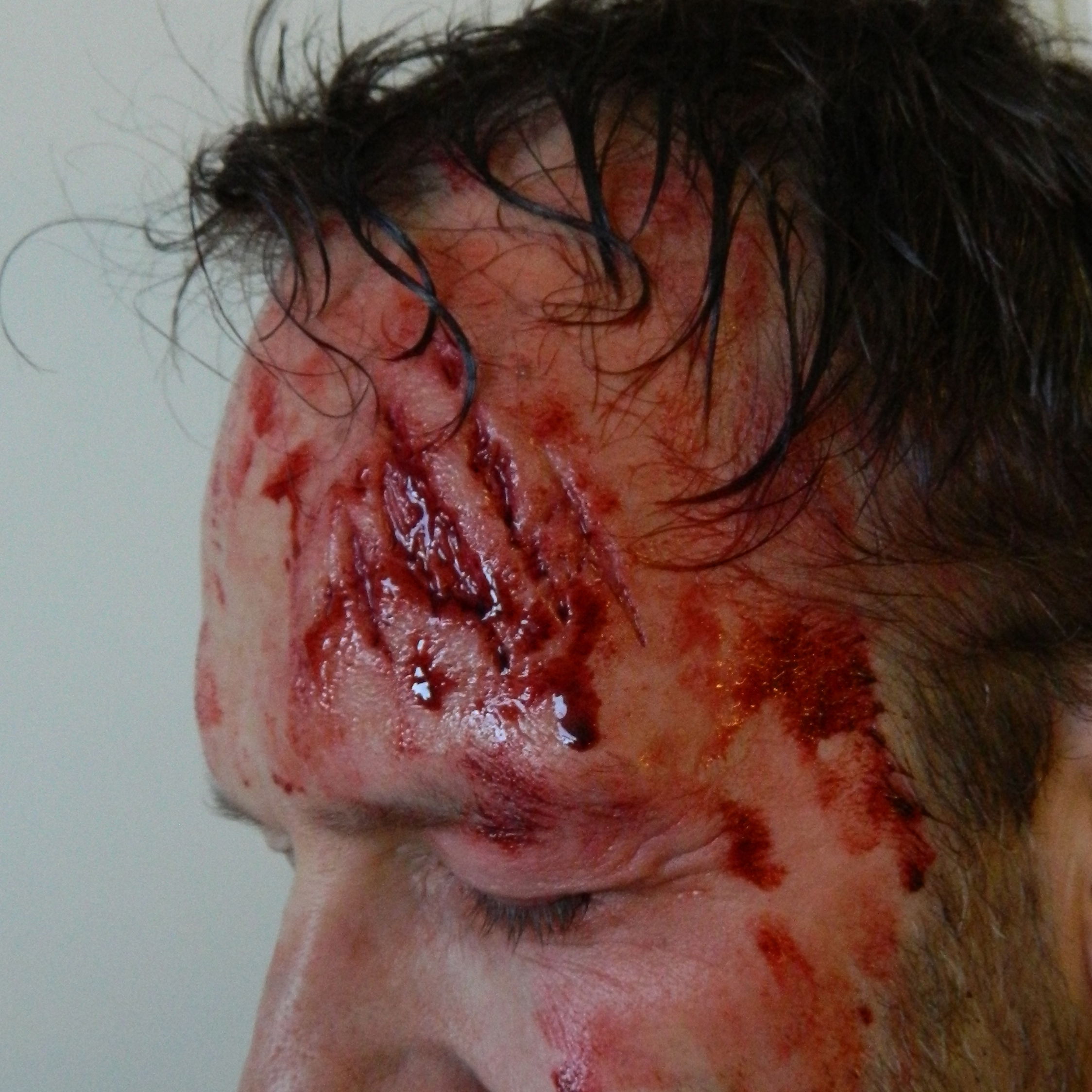Flatmould Form 022 - Krosskada / Uppriven hud / Laceration  - 6