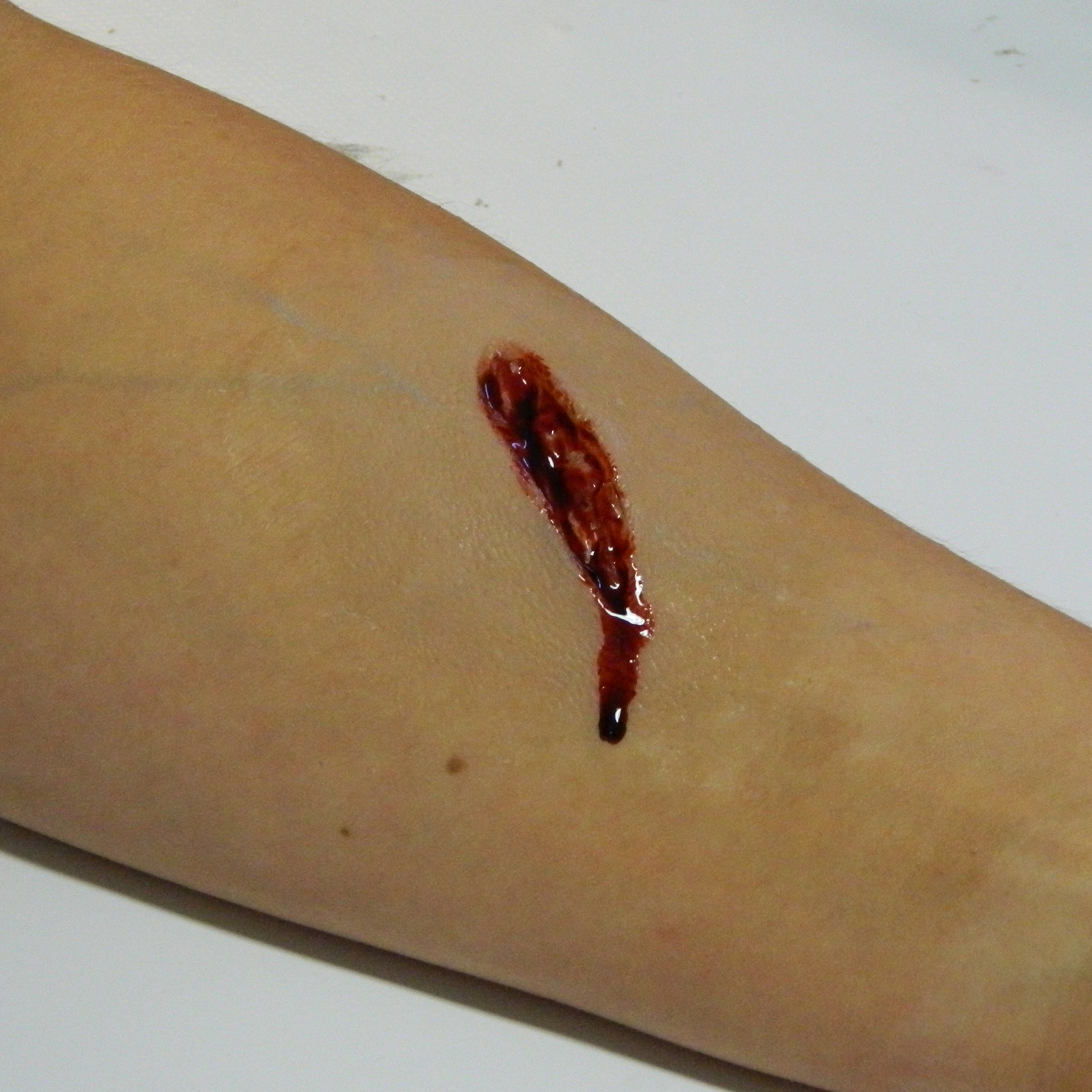 Flatmould Form 028 - Öppet Kniv/Skärsår/Stabwound - 4
