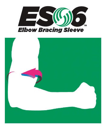 OS1st ES6 Albuestøtte - 6