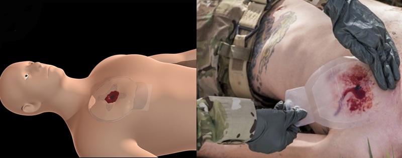 Chest Seal/Thoraxförband, Rhino - 5