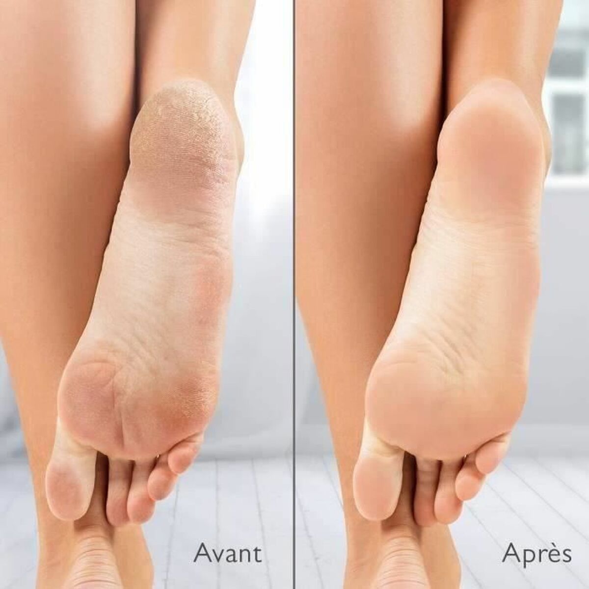 Electric Callus Remover Silk´n Vacupedi (5 antal) - 3