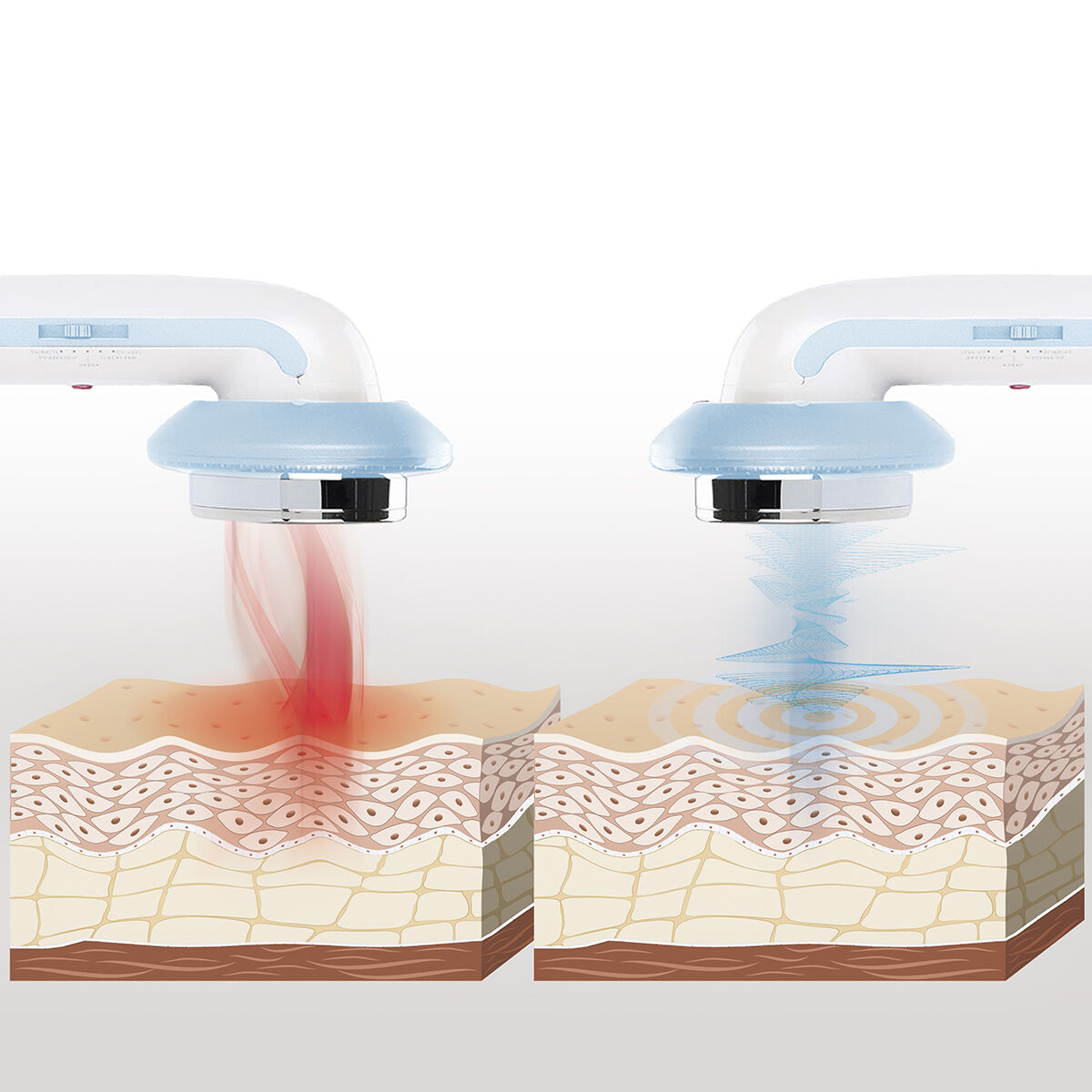 3-i-1 Massageapparat Anti-celluliter med Ultraljudskavitation med Infravärme och Elektrostimulering CellyMax InnovaGoods - 27