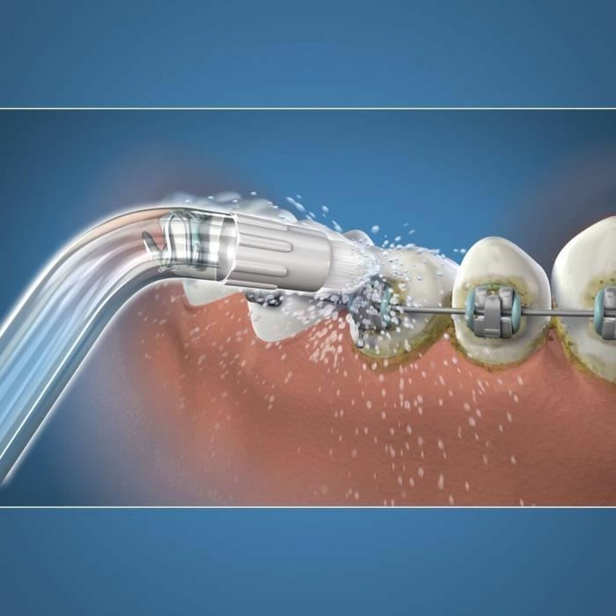 Tandborsthuvud Waterpik OD-100E - 2