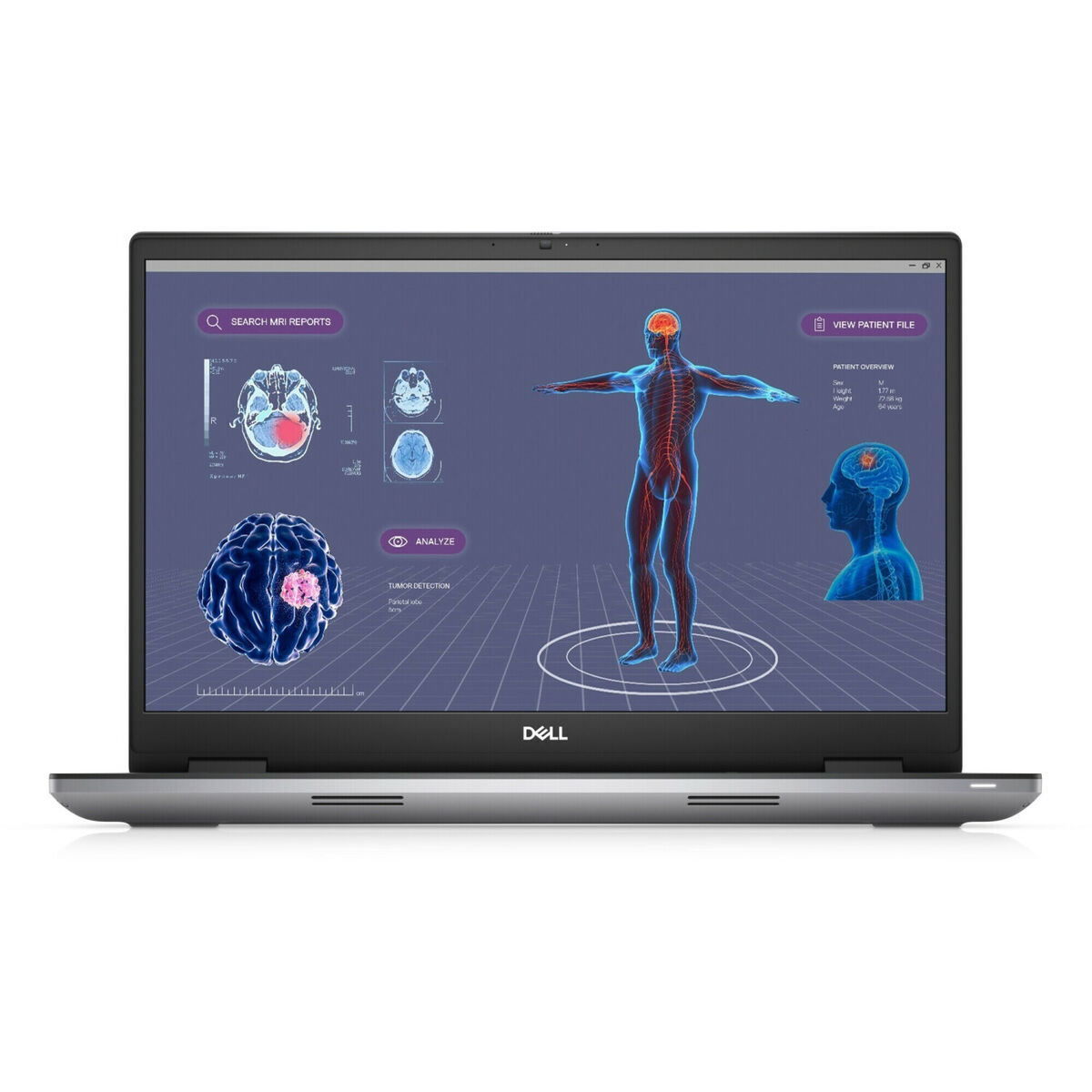 Laptop Dell Precision 7780 Intel Core i7-13850HX 16 GB RAM 512 GB SSD Qwerty Spanska