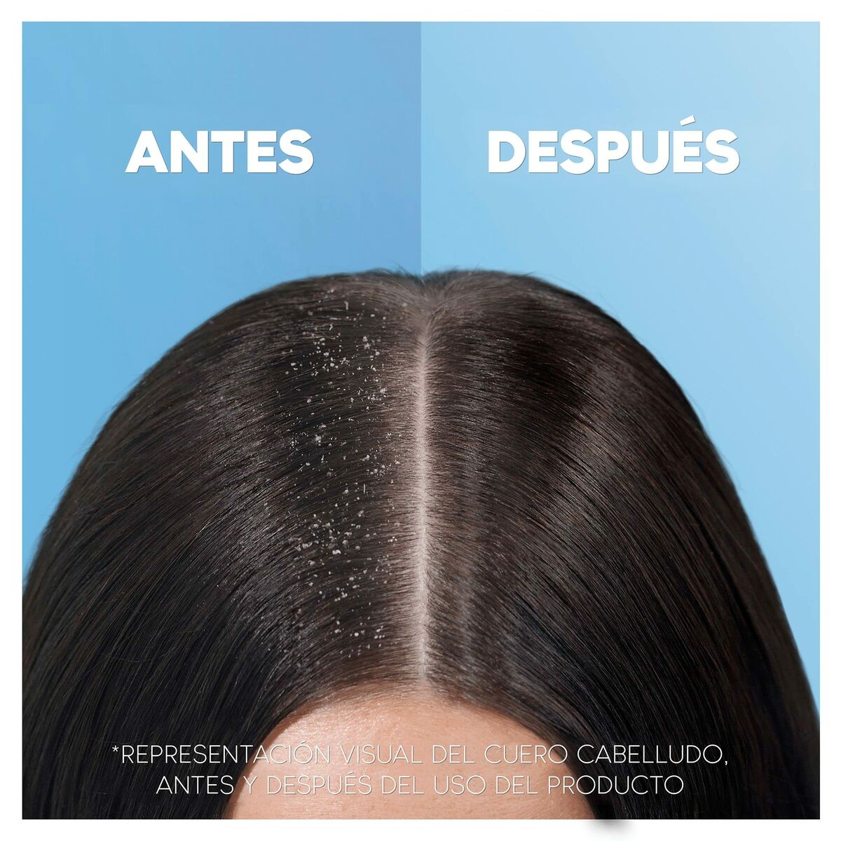 Schampo Head & Shoulders H&S Clásico 1 L 2 i 1 - 4