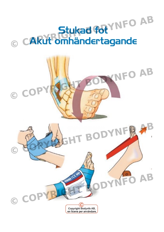 Akut omhändertagande
