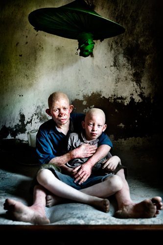 Johan Bävman - Albino - 6
