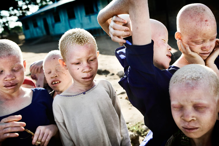 Johan Bävman - Albino - 5