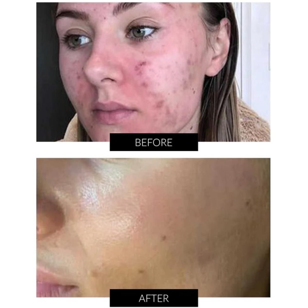 Currentbody Skin Dermalux Flex MD - 7