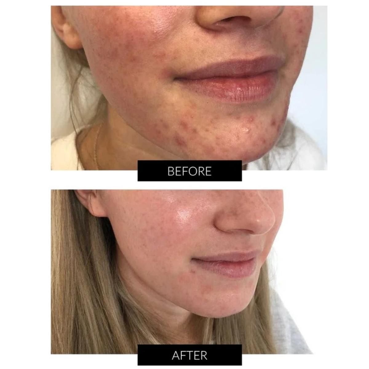 Currentbody Skin Dermalux Flex MD - 10