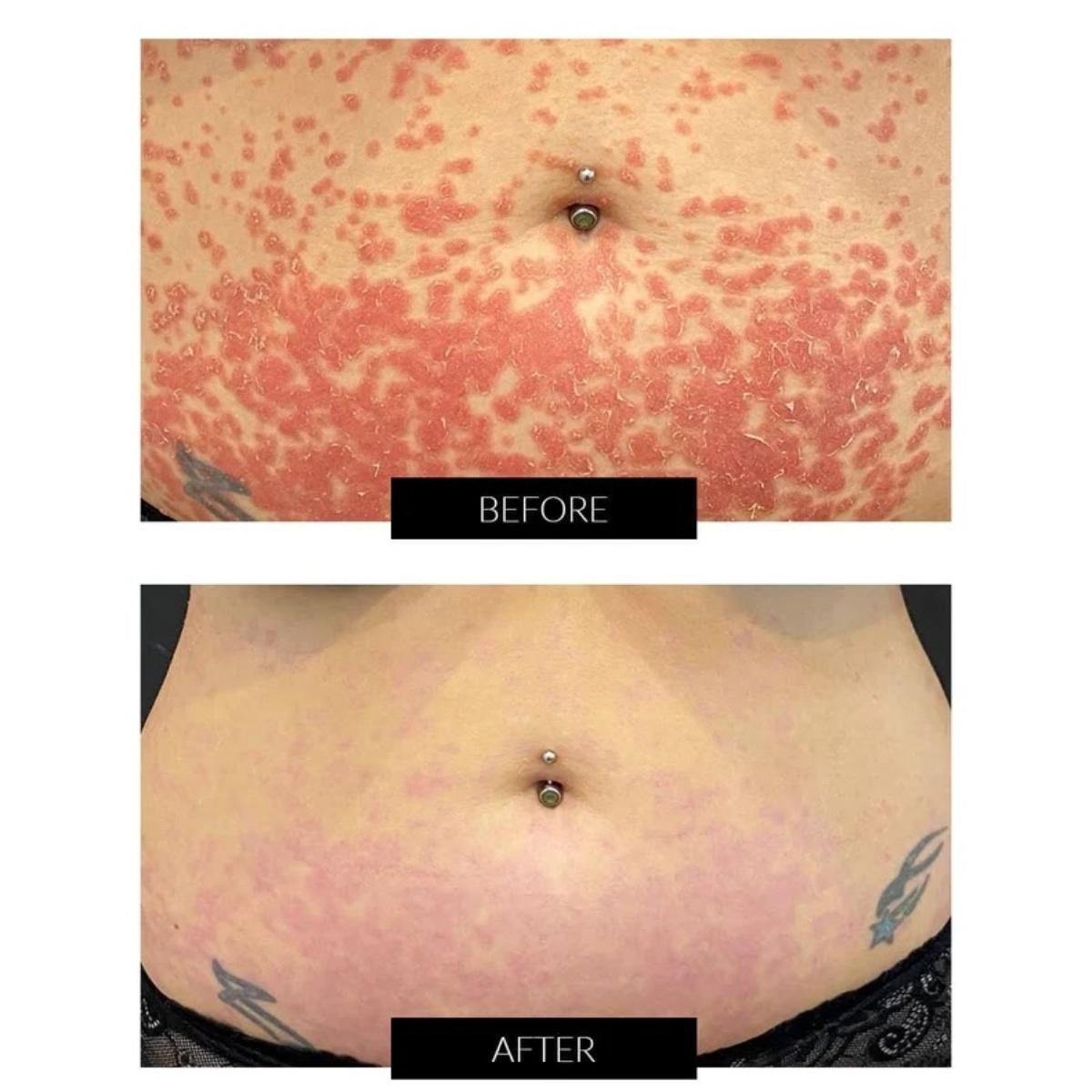 Currentbody Skin Dermalux Flex MD - 9