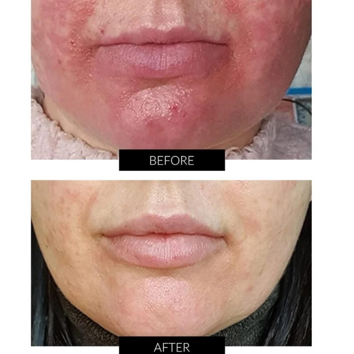 Currentbody Skin Dermalux Flex MD - 6