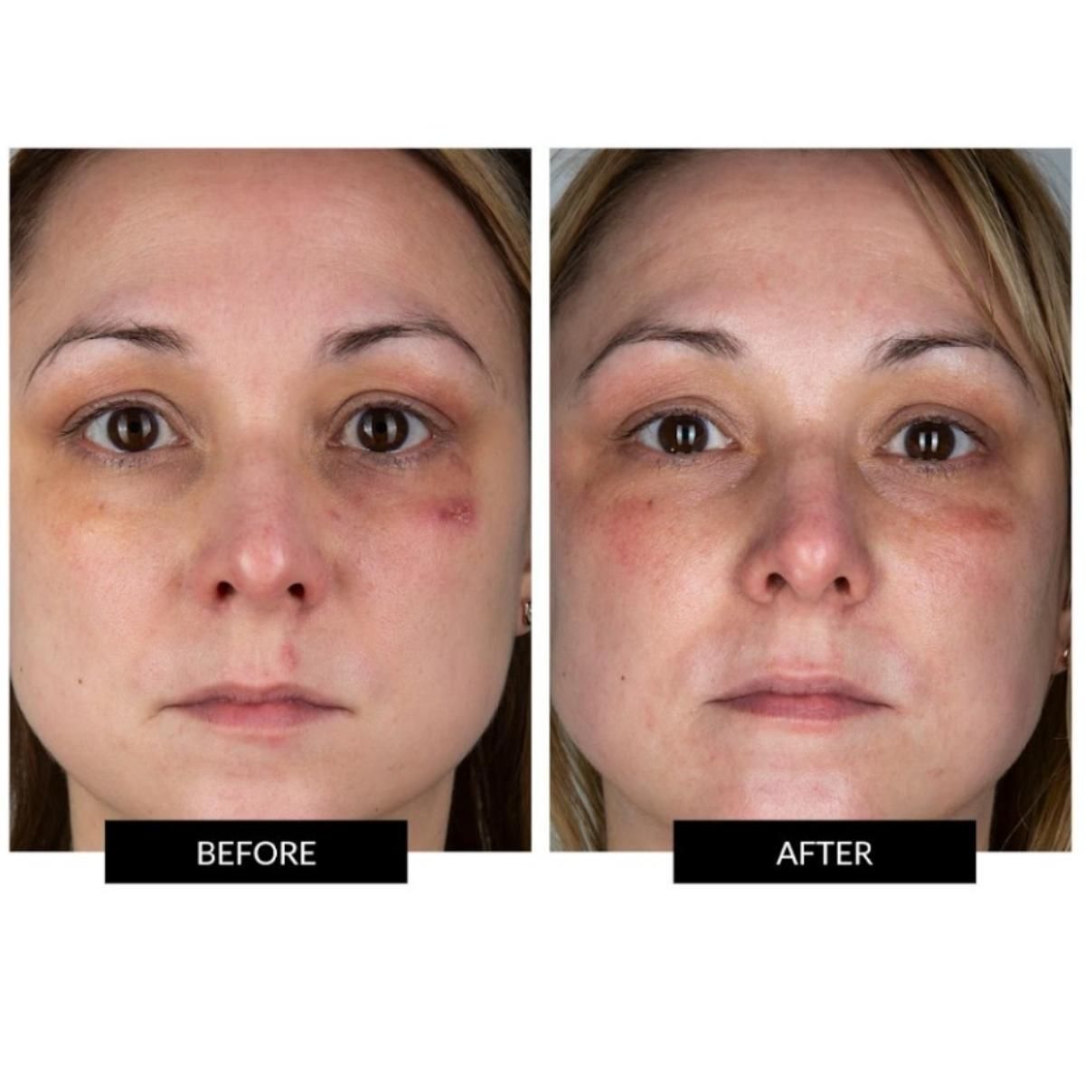 Currentbody Skin Dermalux Flex MD - 11