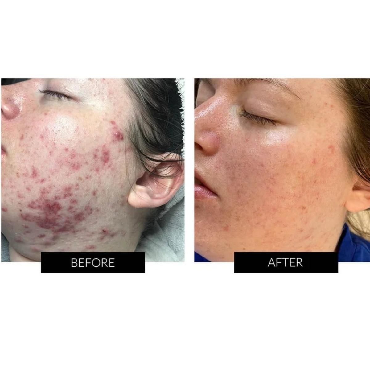 Currentbody Skin Dermalux Flex MD - 4