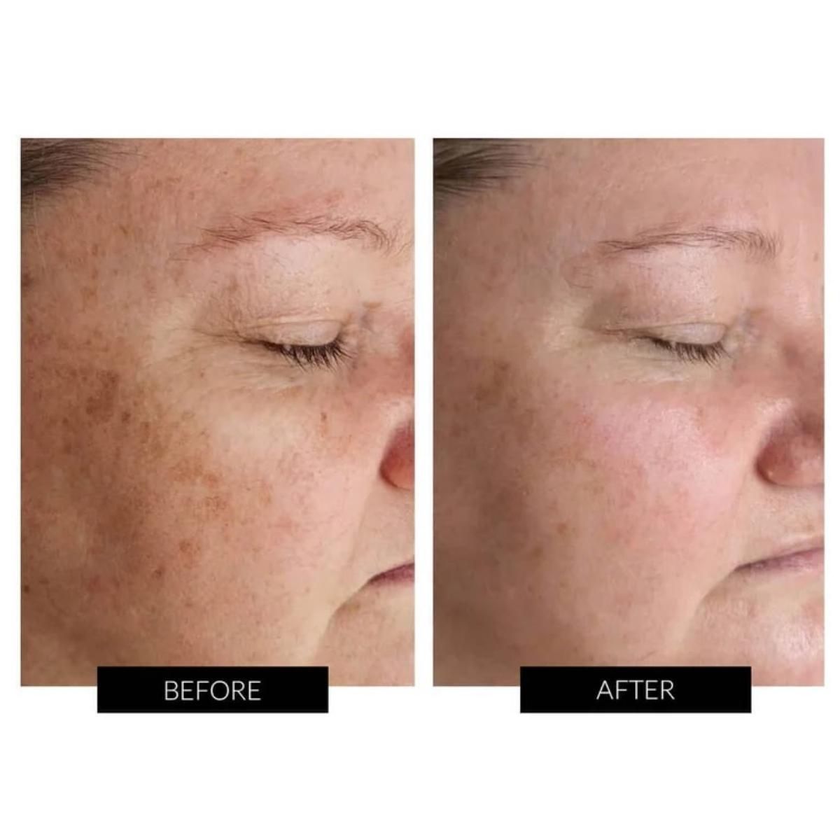Currentbody Skin Dermalux Flex MD - 5