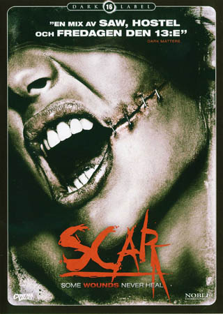 Scar