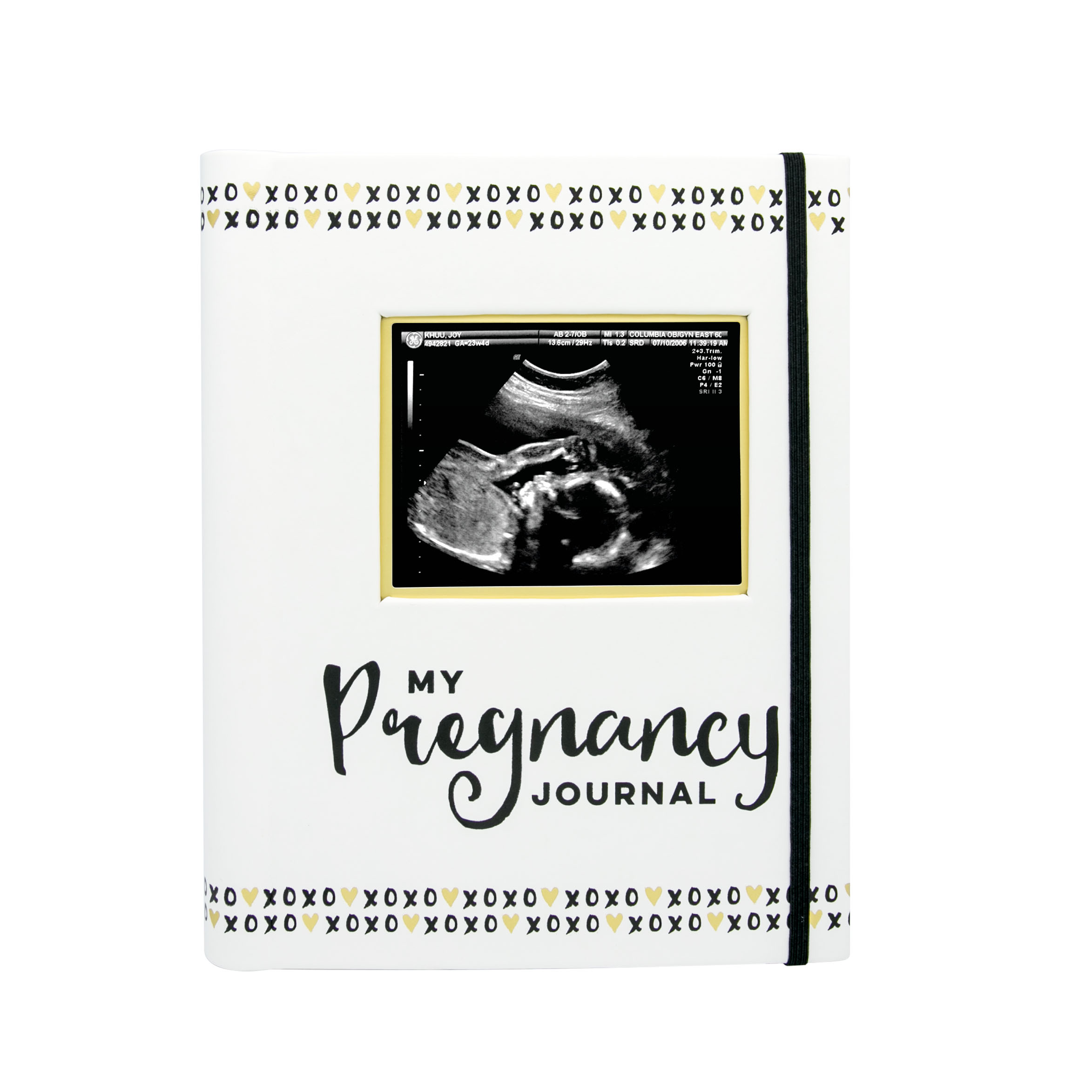 Pregnancy journal white