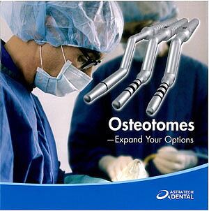 Osteotomes- Expand your options