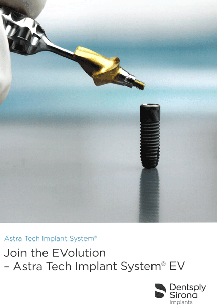 Mapp - Join the EVolution- ASTRA TECH Implant System EV
