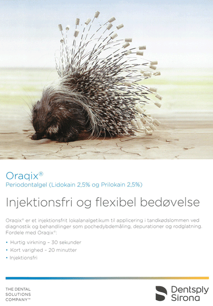 Oraqix - Injektionsfri og flexibel bedøvelse