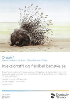 Oraqix - Injektionsfri og flexibel bedøvelse