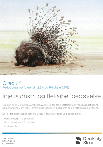 Oraqix - Injeksjonsfri og fleksibel bedøvelse