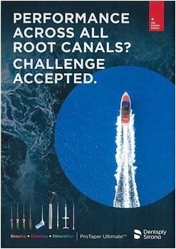 Performance Across All Roots Canals?....