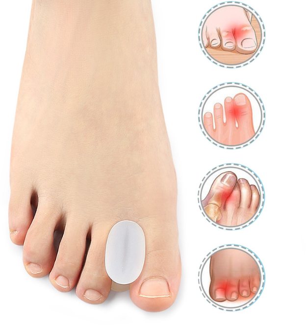 Hallux Valgus tåskiller, 6-pakk - 3