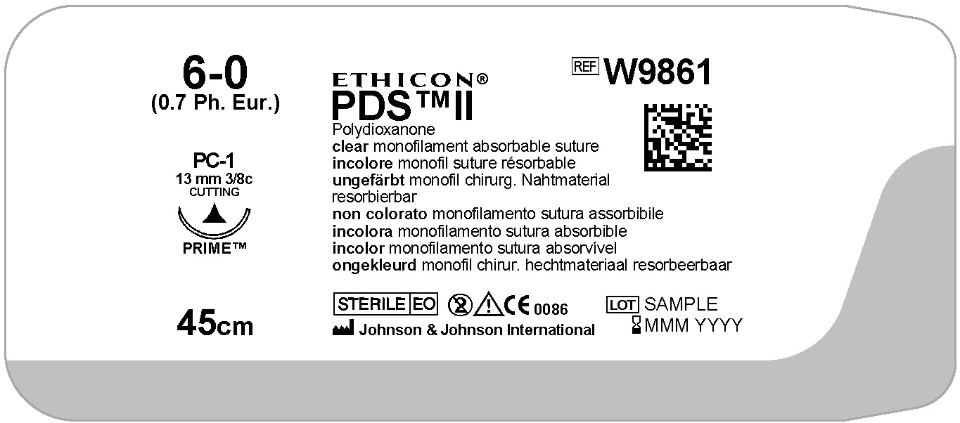 Smith+Nephew's VISIONAIRE™ Patient-Specific Instrumentation