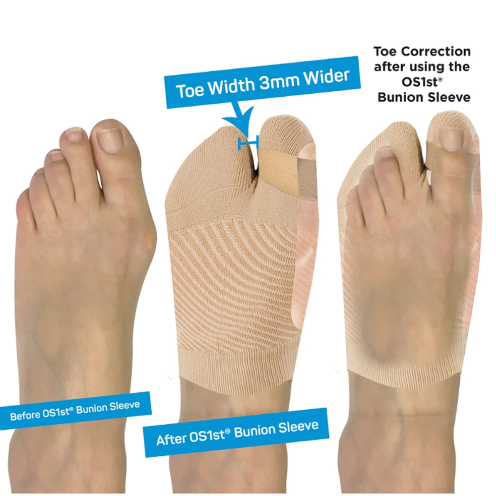 OS1st HV3 Bunion Bracing Sleeve - hallux valgus brace - 4