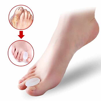 Hallux Valgus Stortåskiljare 2-pack