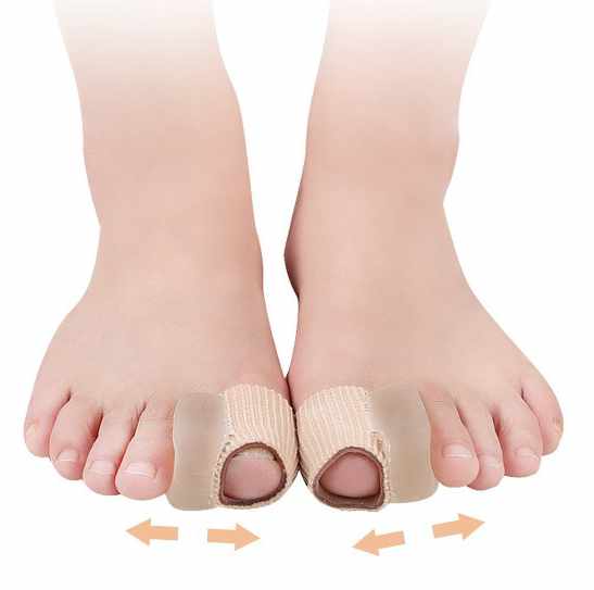 Hallux Valgus - Stortå Separerare - 2